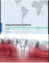 Global Bioimplants Market 2017-2021